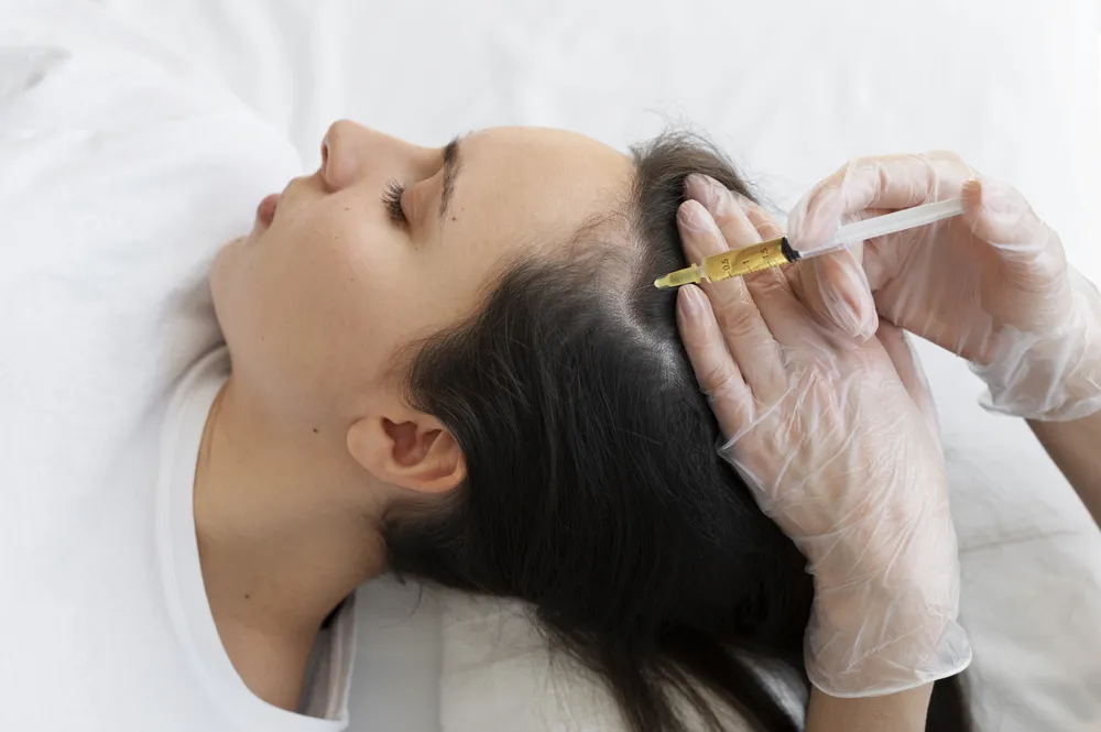PRP hair treatment at clinic